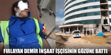 Fırlayan Demir İnşaat İşçisinin Gözüne Battı