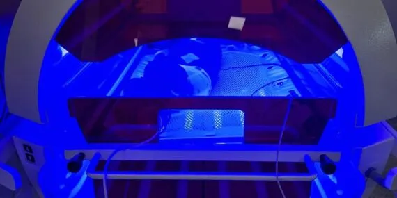 Yenidoğan Sarılığına Bayburt’ta Kesin Çözüm: Son Teknoloji Fototerapi Cihazı Alındı