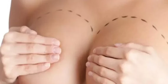 Büyük göğüsler, büyük sorunlar… Ameliyata kimler uygun aday? haberi