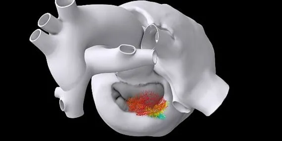 Dassault Systèmes'in FDA ile Ortak Çalışması: Klinik Deneylerde Sanal İkizlerin Kullanımına Yönelik Yenilikçi Bir Kılavuz haberi