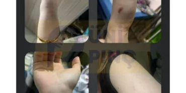 Edirne Keşan KYK Kız Yurdu'nda şiddet iddiası! haberi