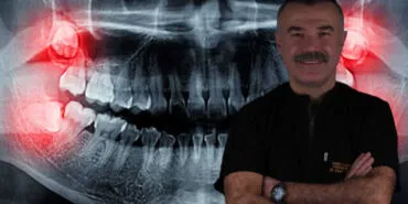 Yirmilik dişler ihmale gelmiyor! haberi