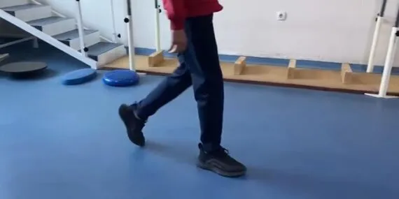 Bayburt’ta Yıllardır Parmak Ucunda Yürüyen Çocuk Fizik Tedaviyle Sağlığına Kavuştu