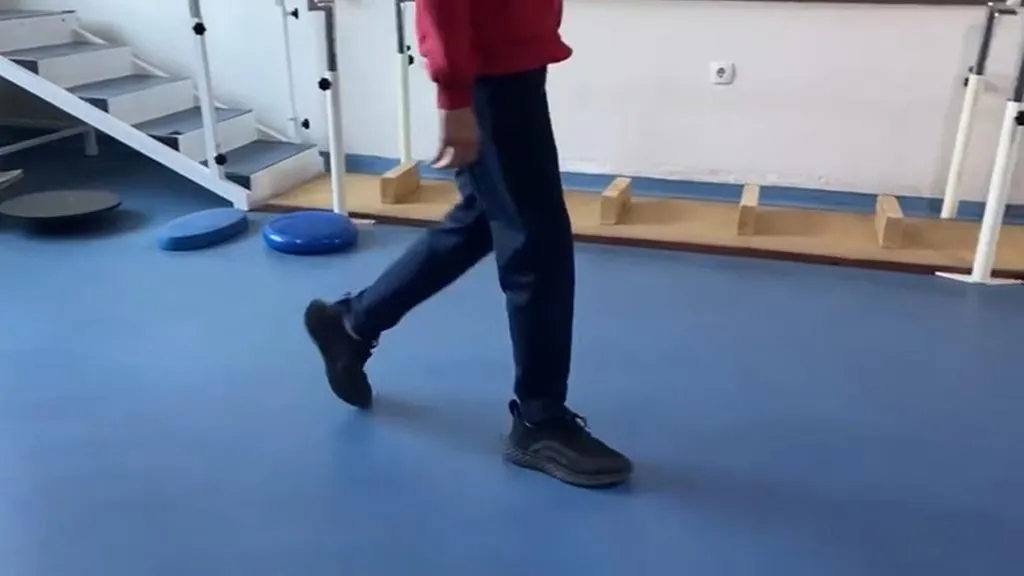 Yıllardır Parmak Ucunda Yürüyen Çocuk Fizik Tedaviyle Sağlığına Kavuştu