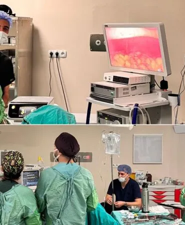 Türkiye’de Sayılı Merkezde Yapılan V-Notes İzsiz Cerrahi, Bayburt’ta İlk Kez Uygulandı