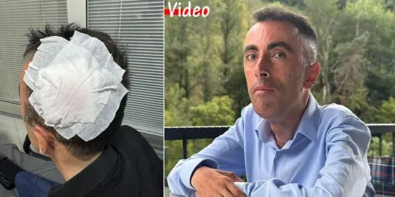 Bayburt’ta Trafik Kazasında Karar, Engin Demir Ölmemiz mi Gerekiyor?